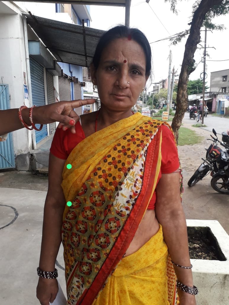 Premier India | पीकेडीएल बीमारी को हरा पुष्पा अब जी रही है नयी जिन्दगी